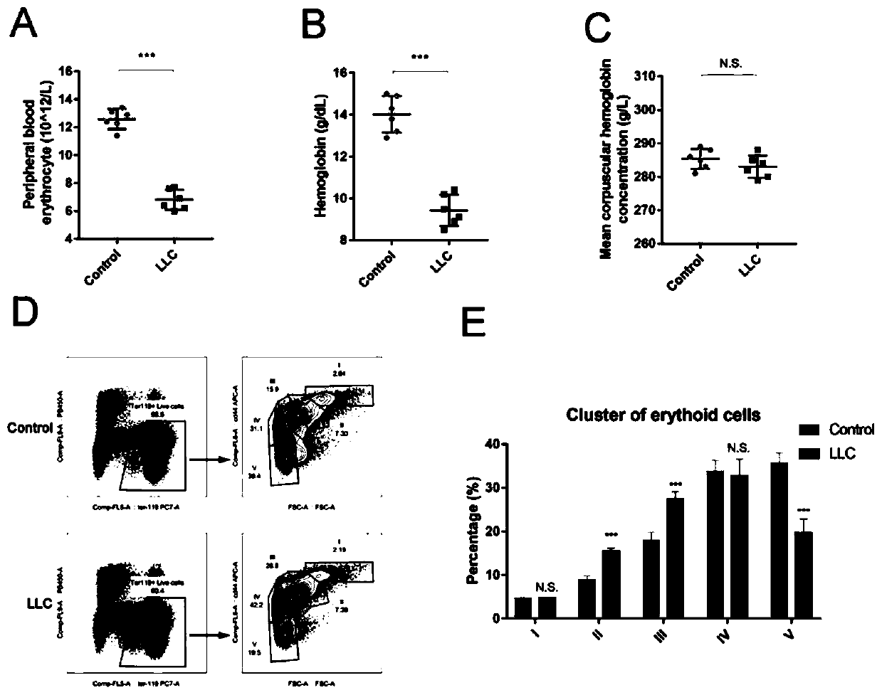 Application of TGF signal inhibitor in preventing and treating cancerous anemia