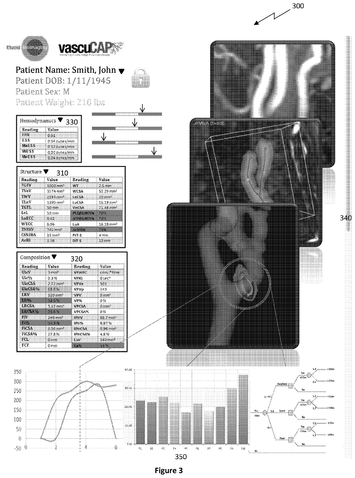 Non-invasive risk stratification for atherosclerosis