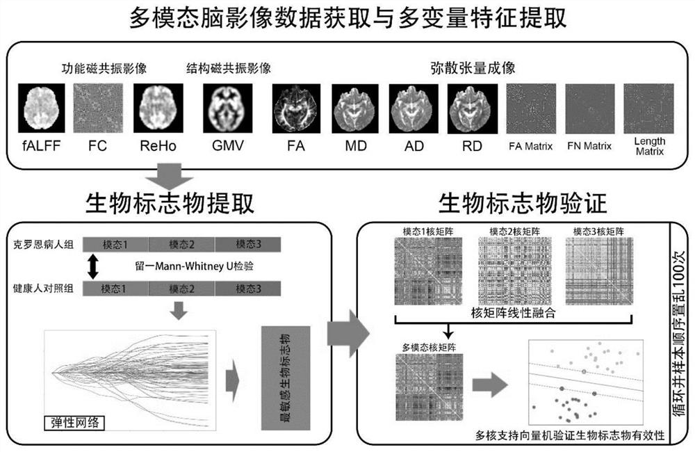 Multi-modal brain image data processing method and device, equipment and storage medium