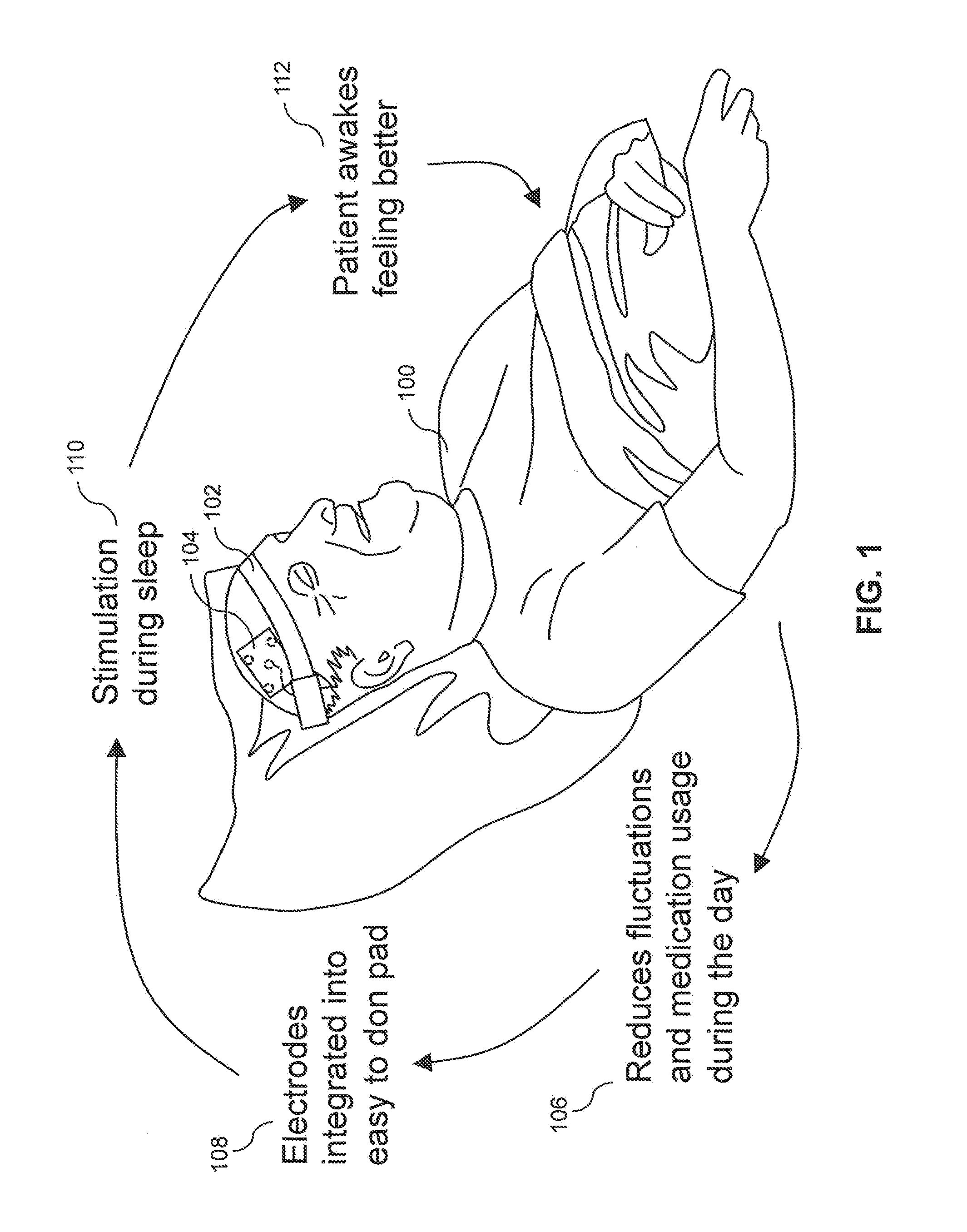 Wearable, unsupervised transcranial direct current stimulation (tDCS) device for movement disorder therapy, and method of using