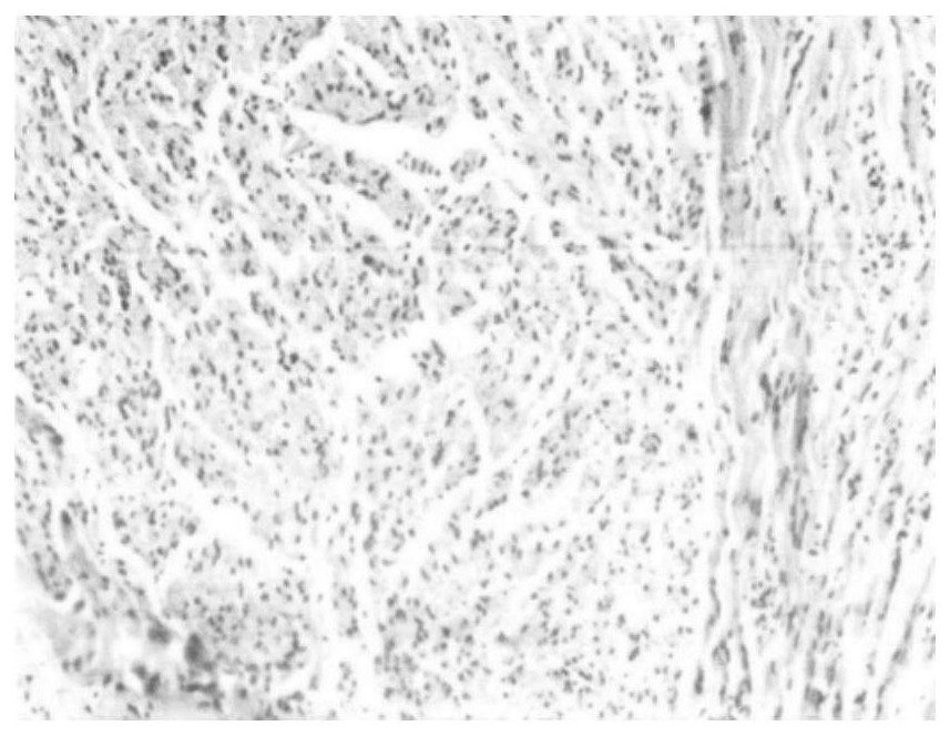 A controllable biodegradable copolymer with basic copolymerization center