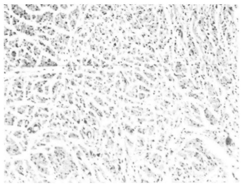 A controllable biodegradable copolymer with basic copolymerization center