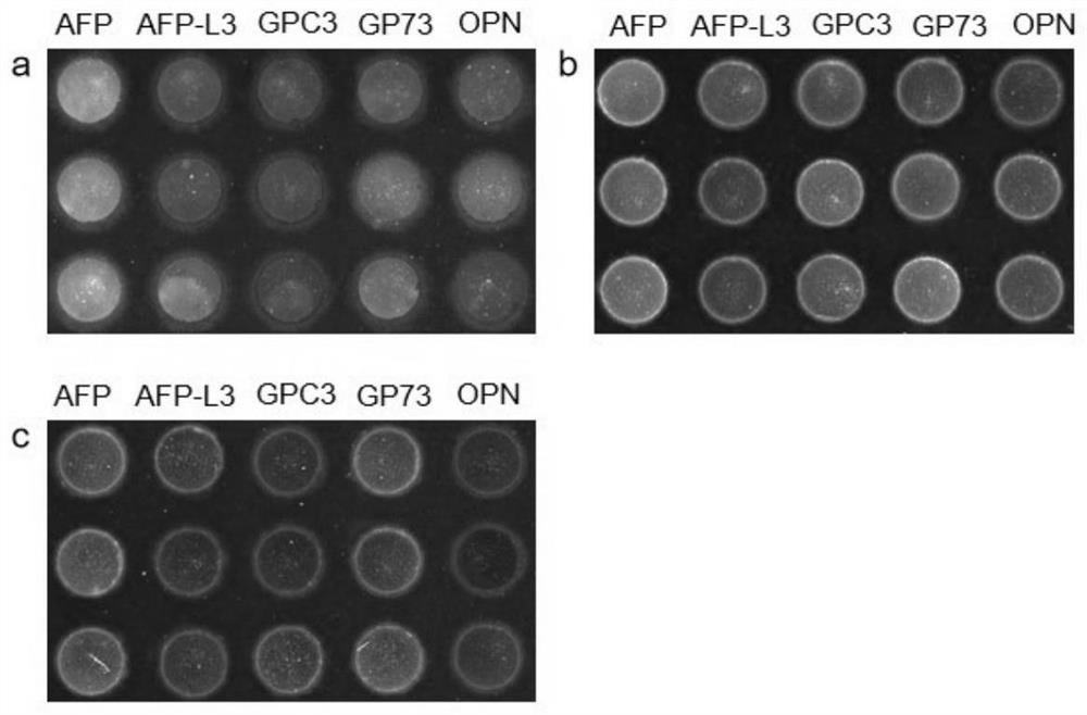 Biochip for combined detection of multiple tumor markers and preparation and application thereof