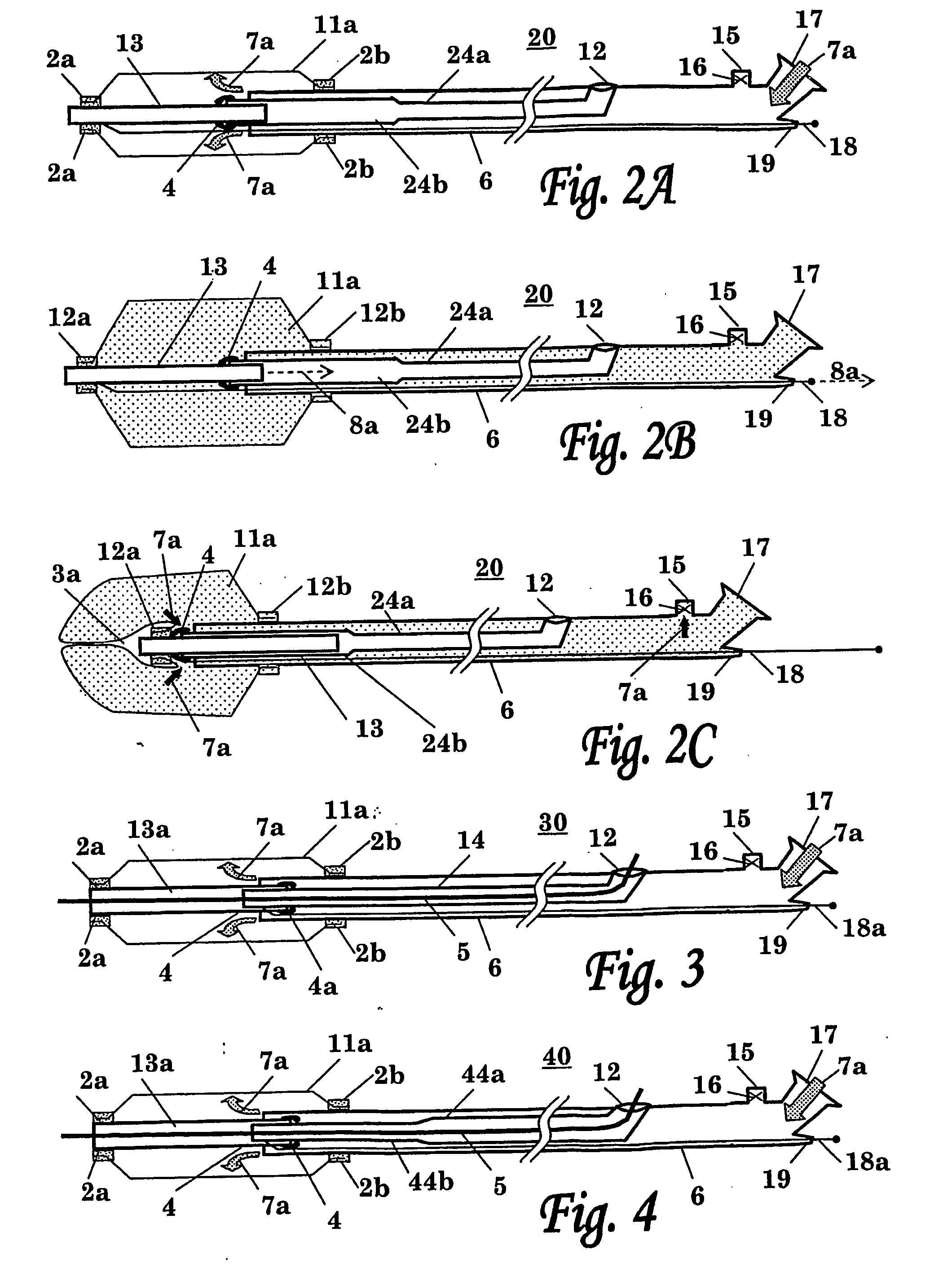 Balloon Catheter