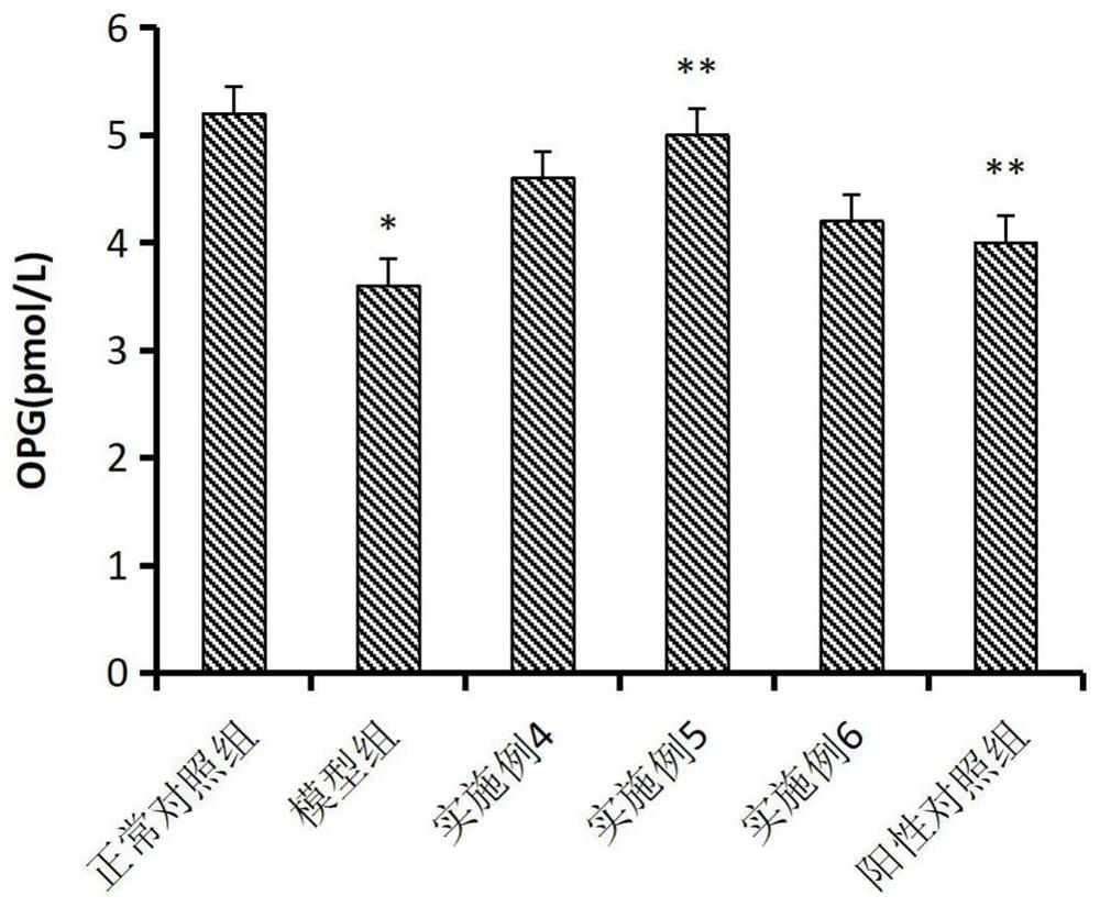 Vitamin K2-containing pharmaceutical composition for improving cardiovascular calcification as well as preparation method and application thereof