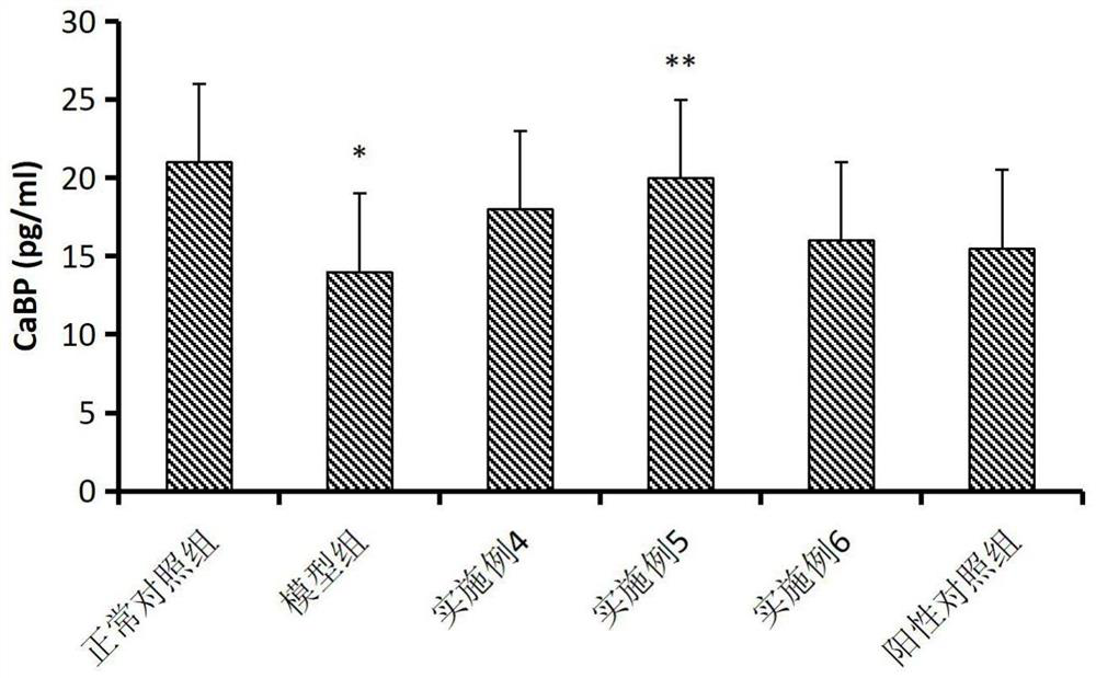 Vitamin K2-containing pharmaceutical composition for improving cardiovascular calcification as well as preparation method and application thereof