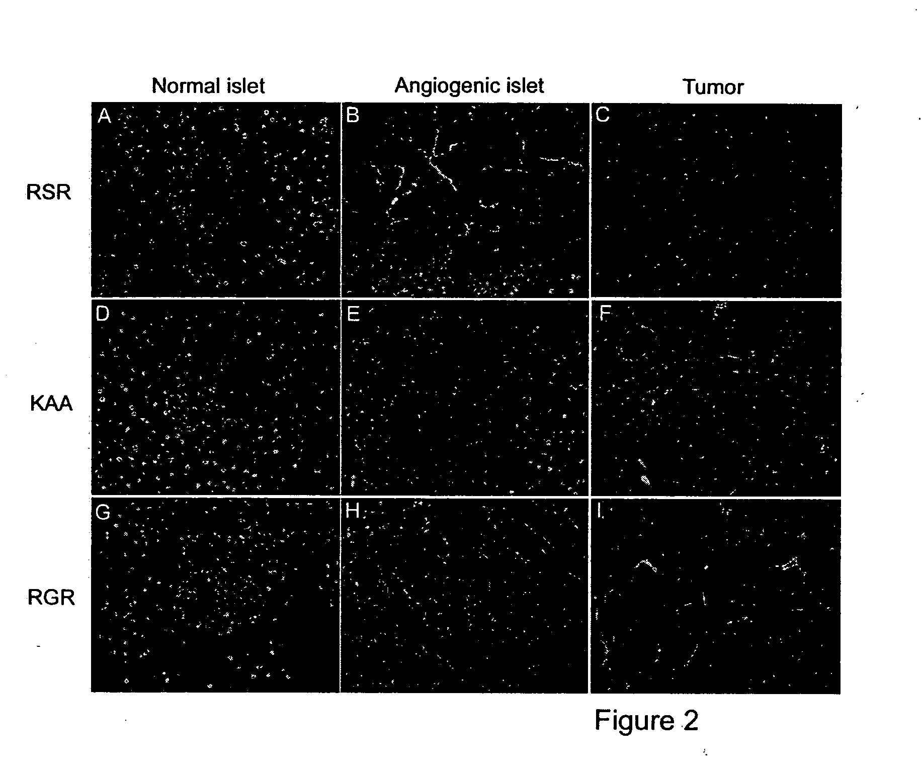 Molecules that selectively home to vasculature of premalignant or malignant lesions of the pancreas and other organs