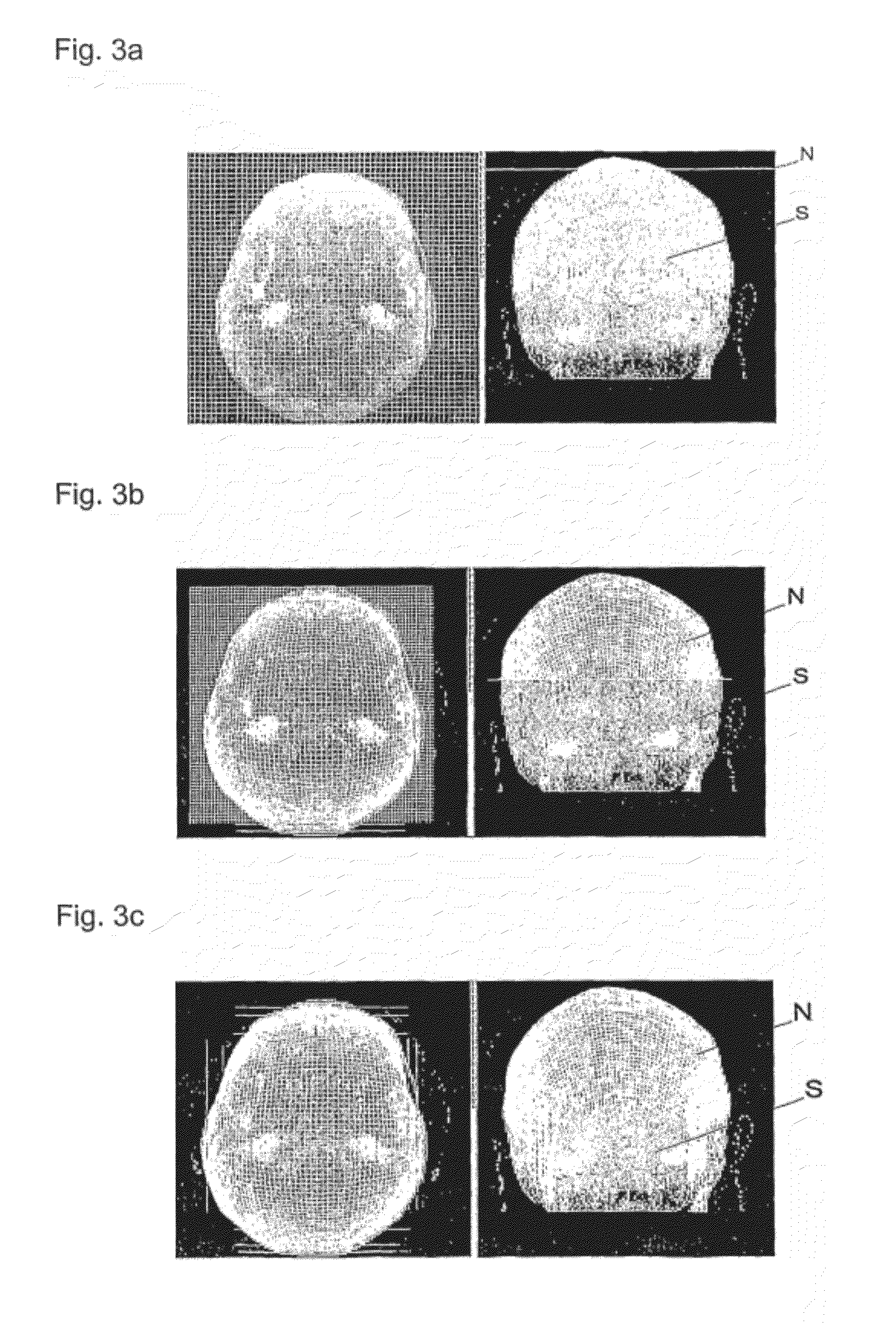 Method and device for processing 3-D image data of a skull