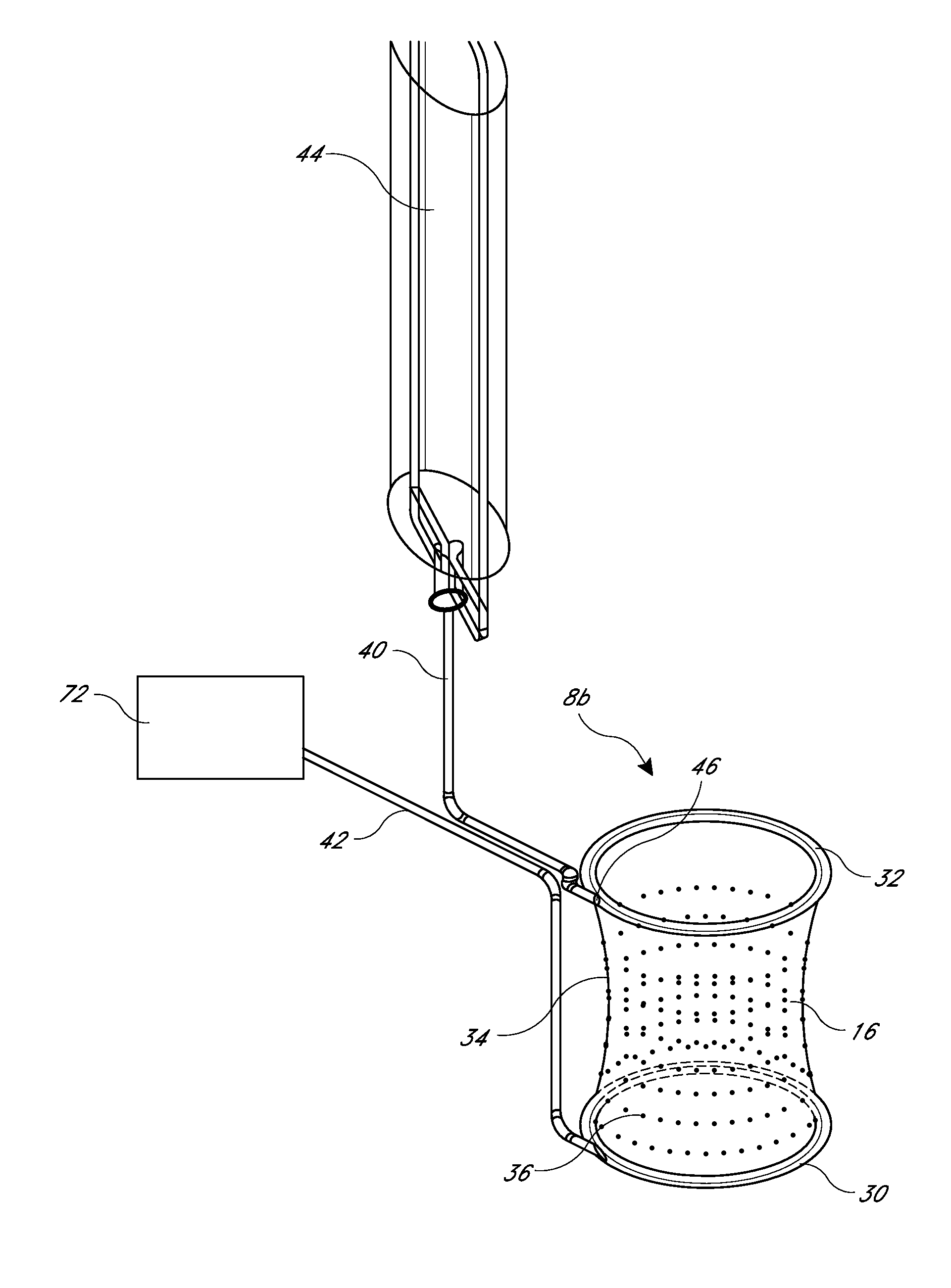 Systems for the prevention of surgical site infections