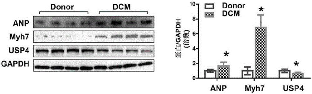 Function and application of ubiquitin specific protease 4 (USP4) in treating cardiac hypertrophy