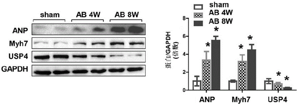 Function and application of ubiquitin specific protease 4 (USP4) in treating cardiac hypertrophy