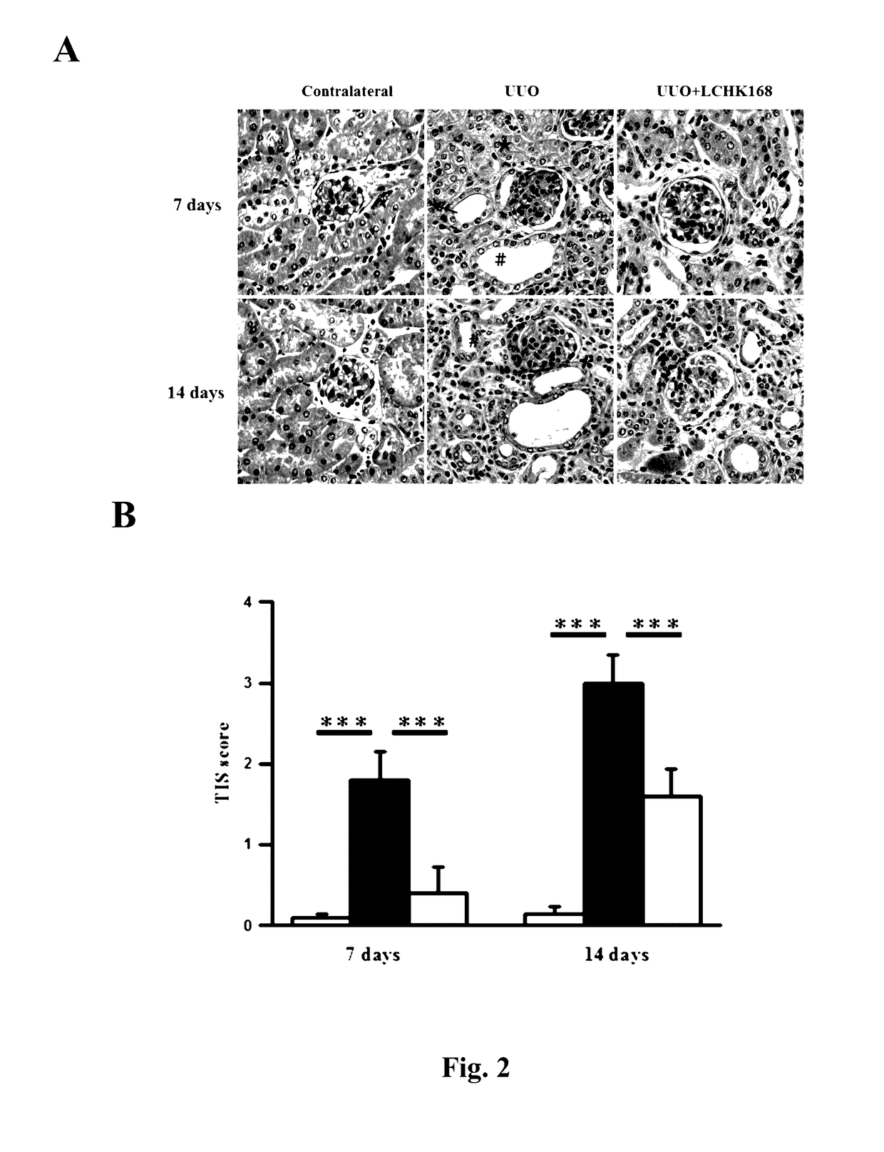 Use of ginsenoside m1 for inhibiting renal fibrosis