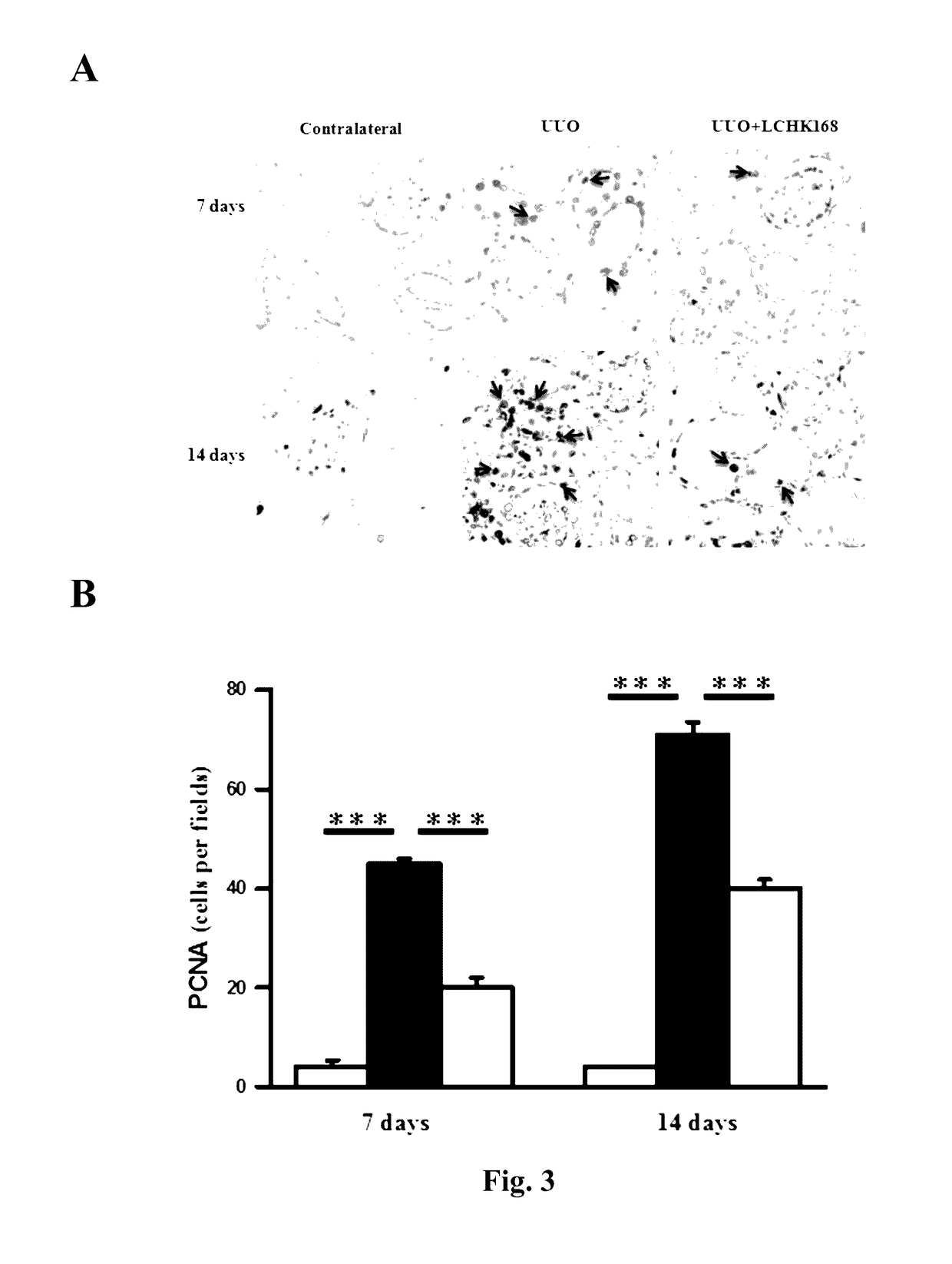 Use of ginsenoside m1 for inhibiting renal fibrosis