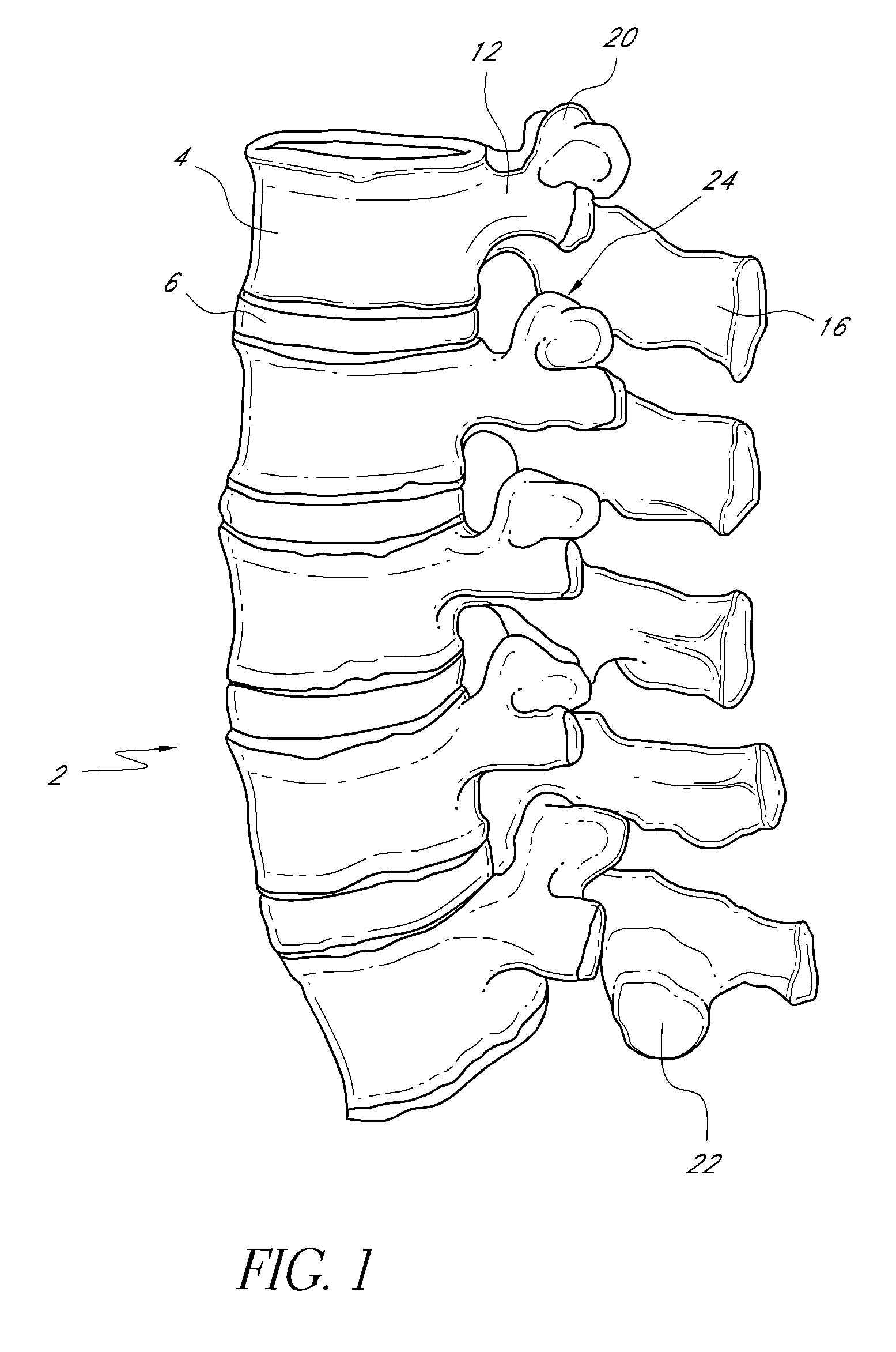 Transverse connectors