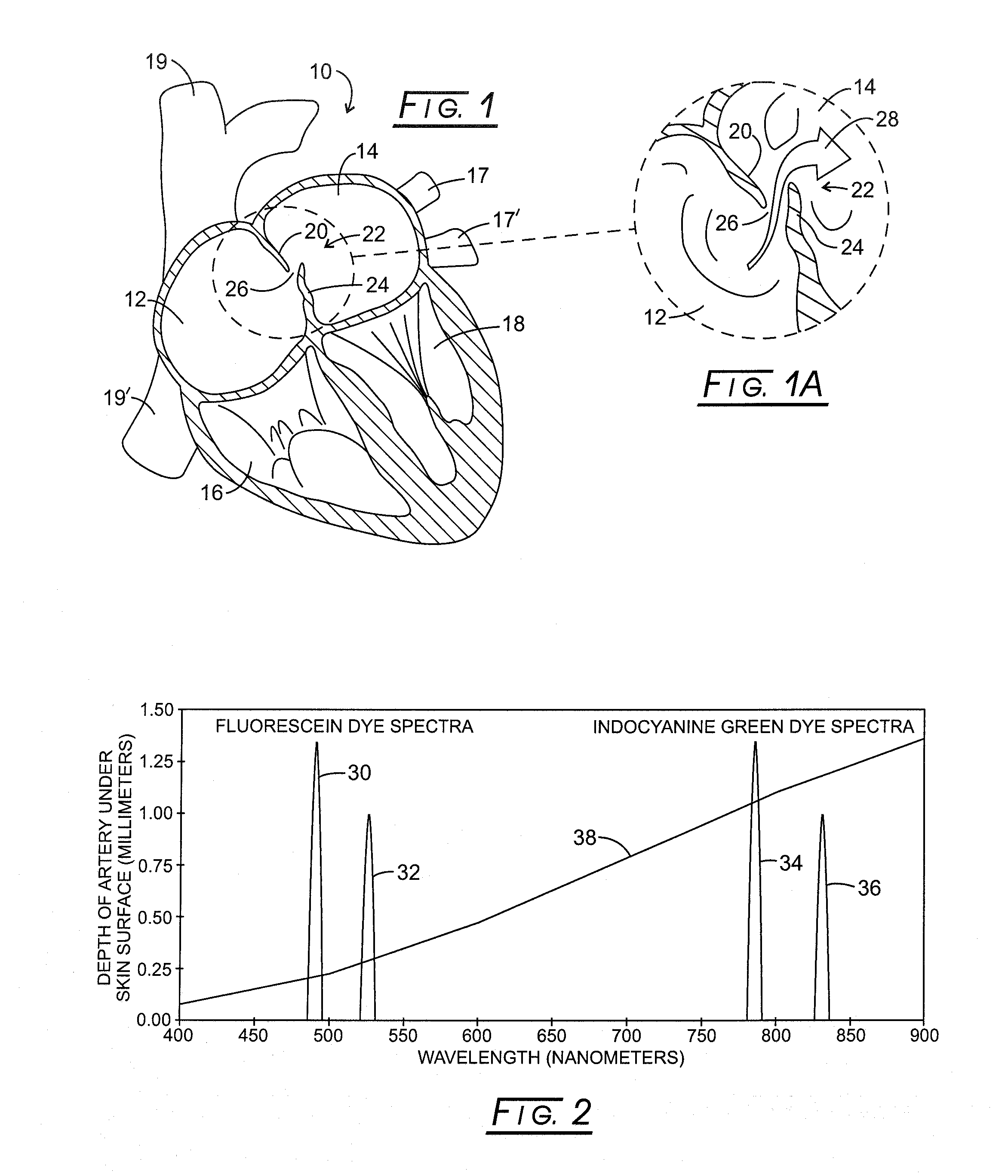 Systems and methods for hemodynamic detection of circulatory anomalies