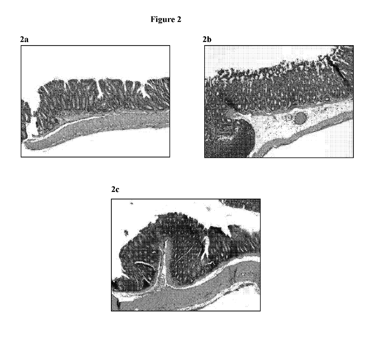 Novel Clostridium Difficile Toxin Inhibitors