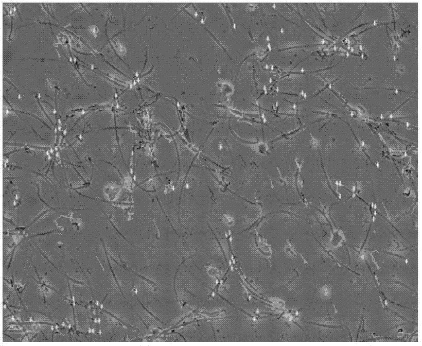 Botanical drug compound recipe for preventing and treating microwave radiation injury