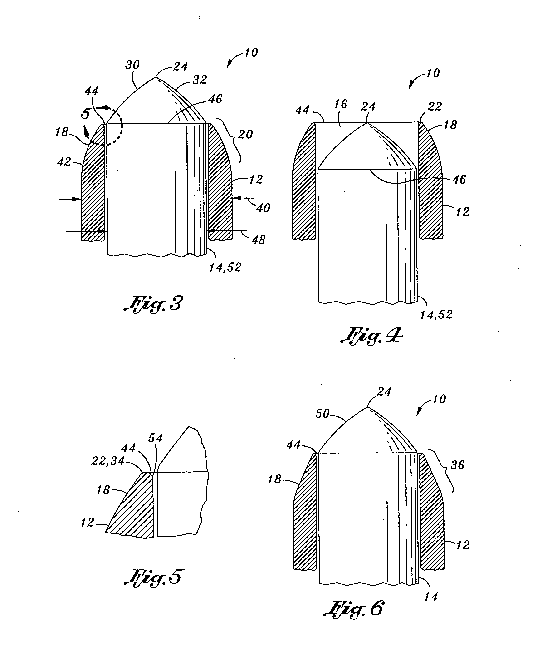 Cleveland round tip (CRT) needle