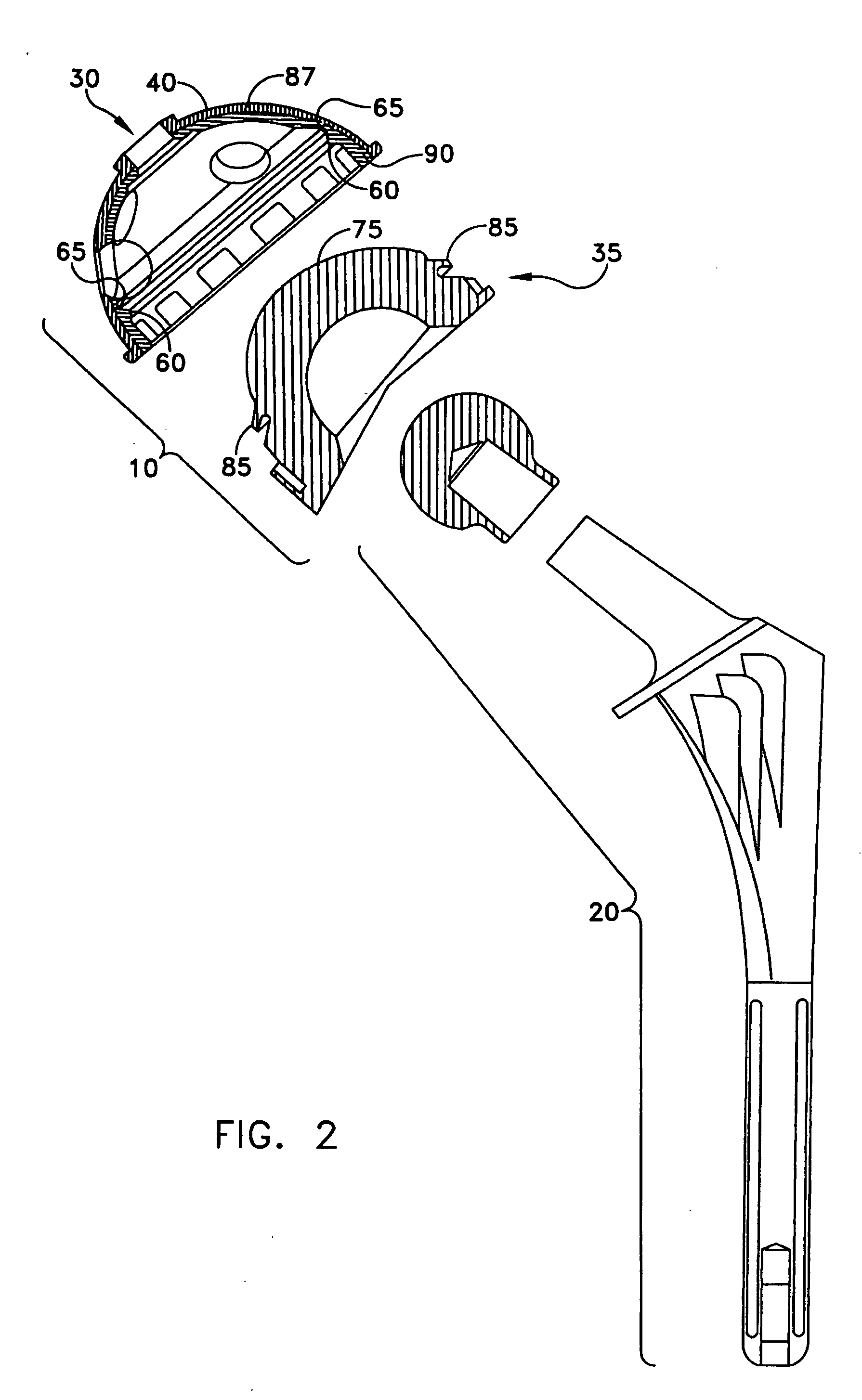 Bimetal acetabular component construct for hip joint prosthesis