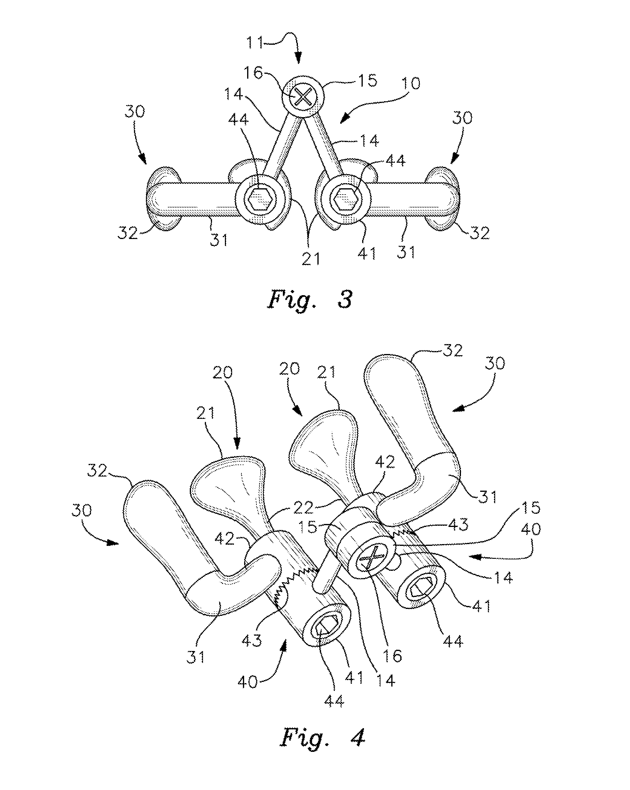 Dynamic Nasal Molding Method