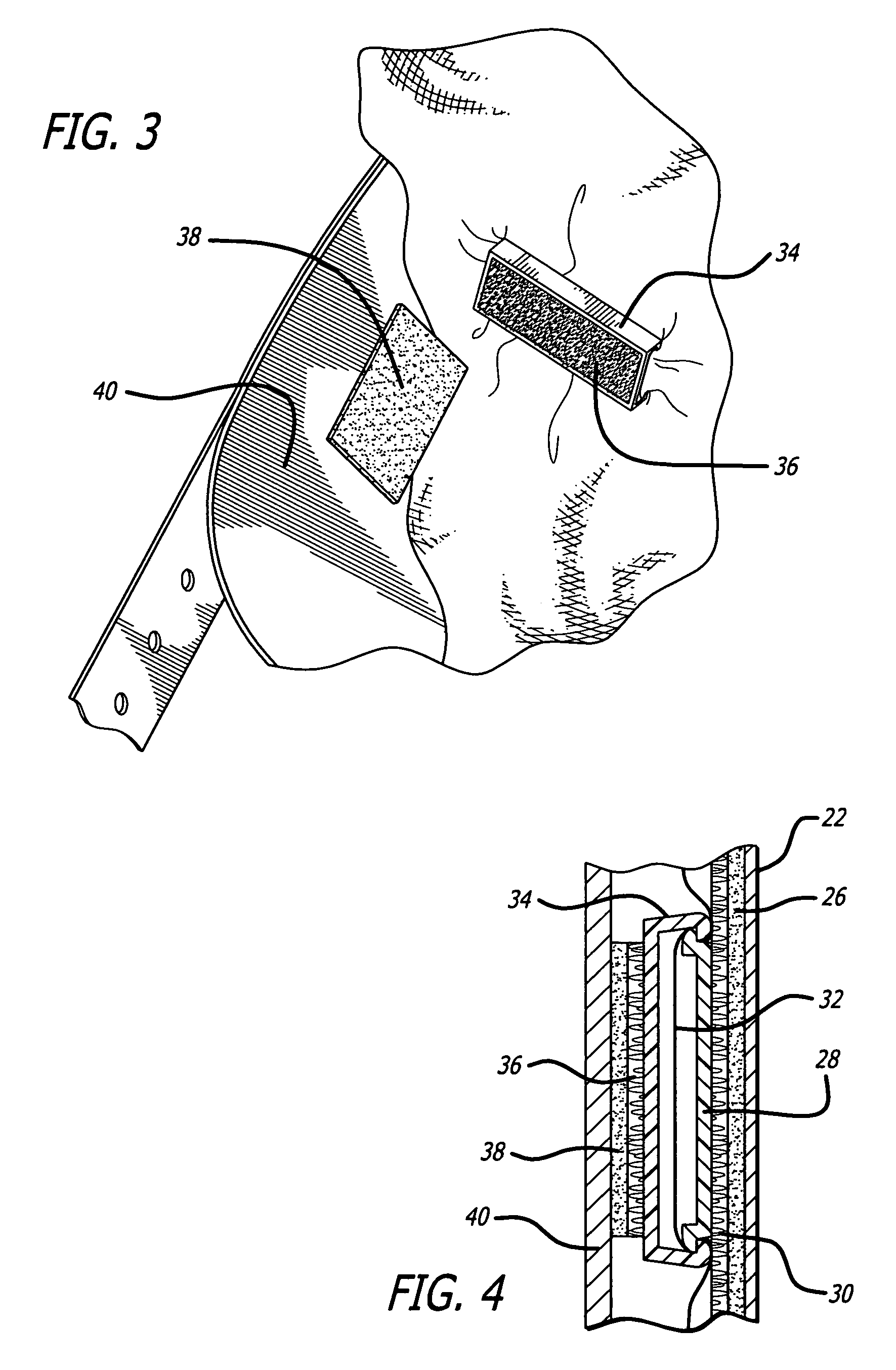 Internal suspenders