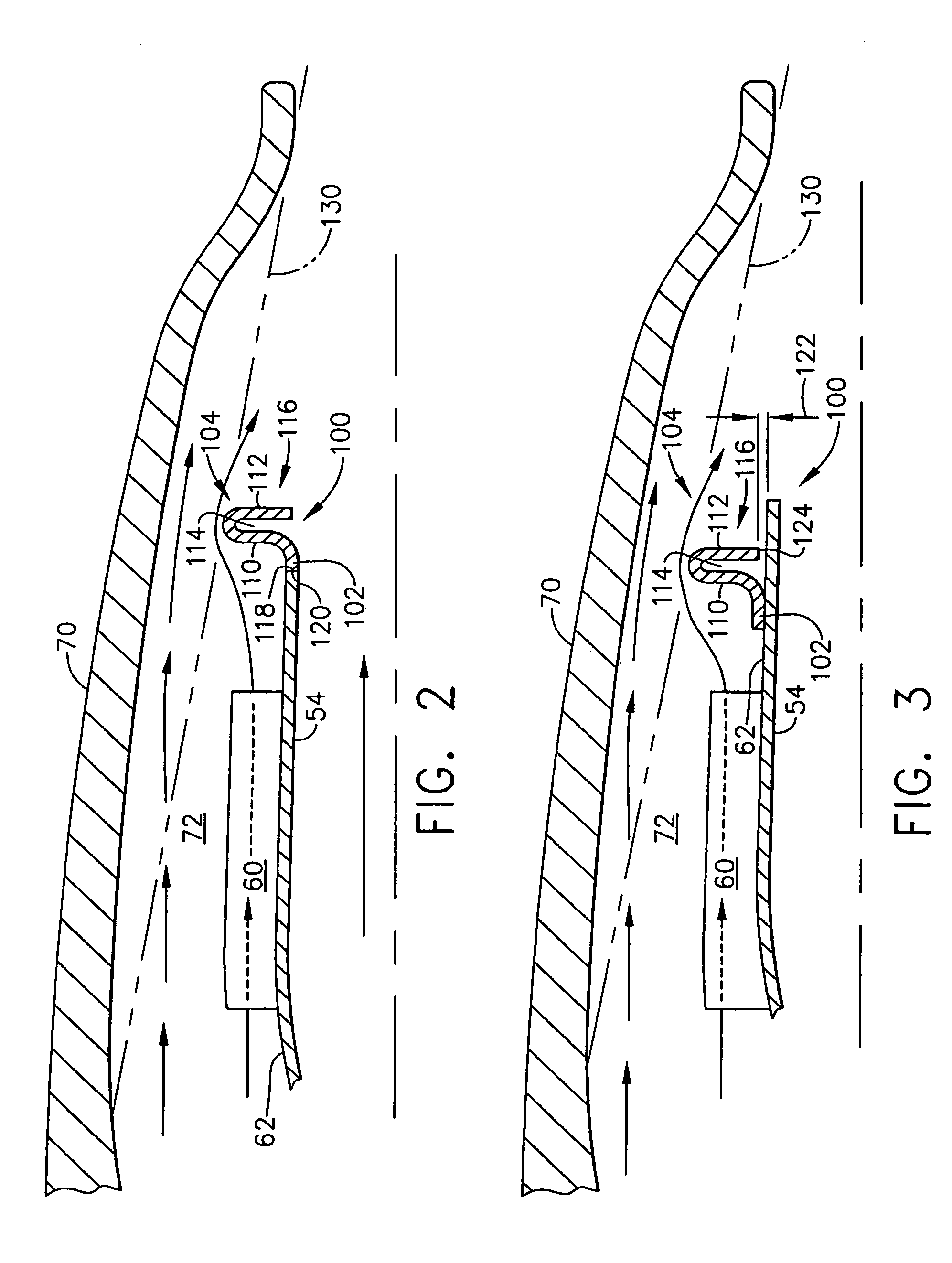 Gas turbine engine exhaust nozzle including an infrared suppression system having a plurality of U-shaped blocking fins and method of assembling said exhaut nozzle