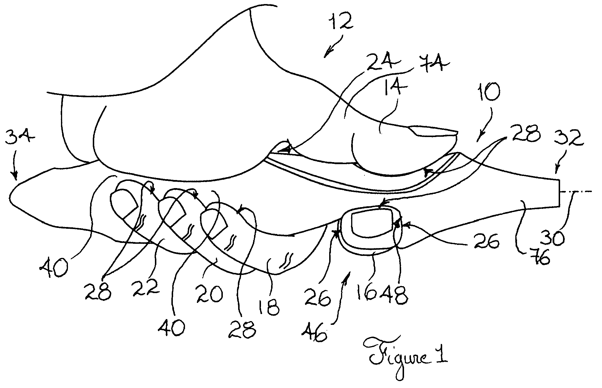 Implement handle