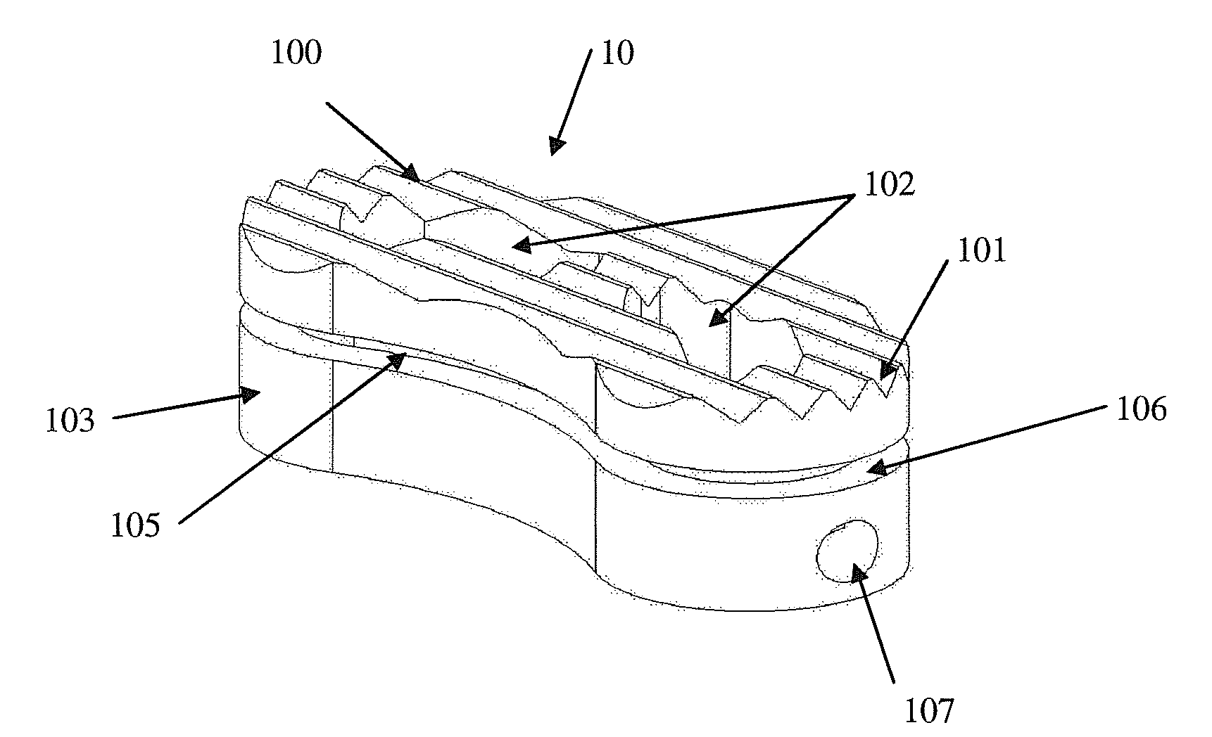 Load sharing interbody fusion device