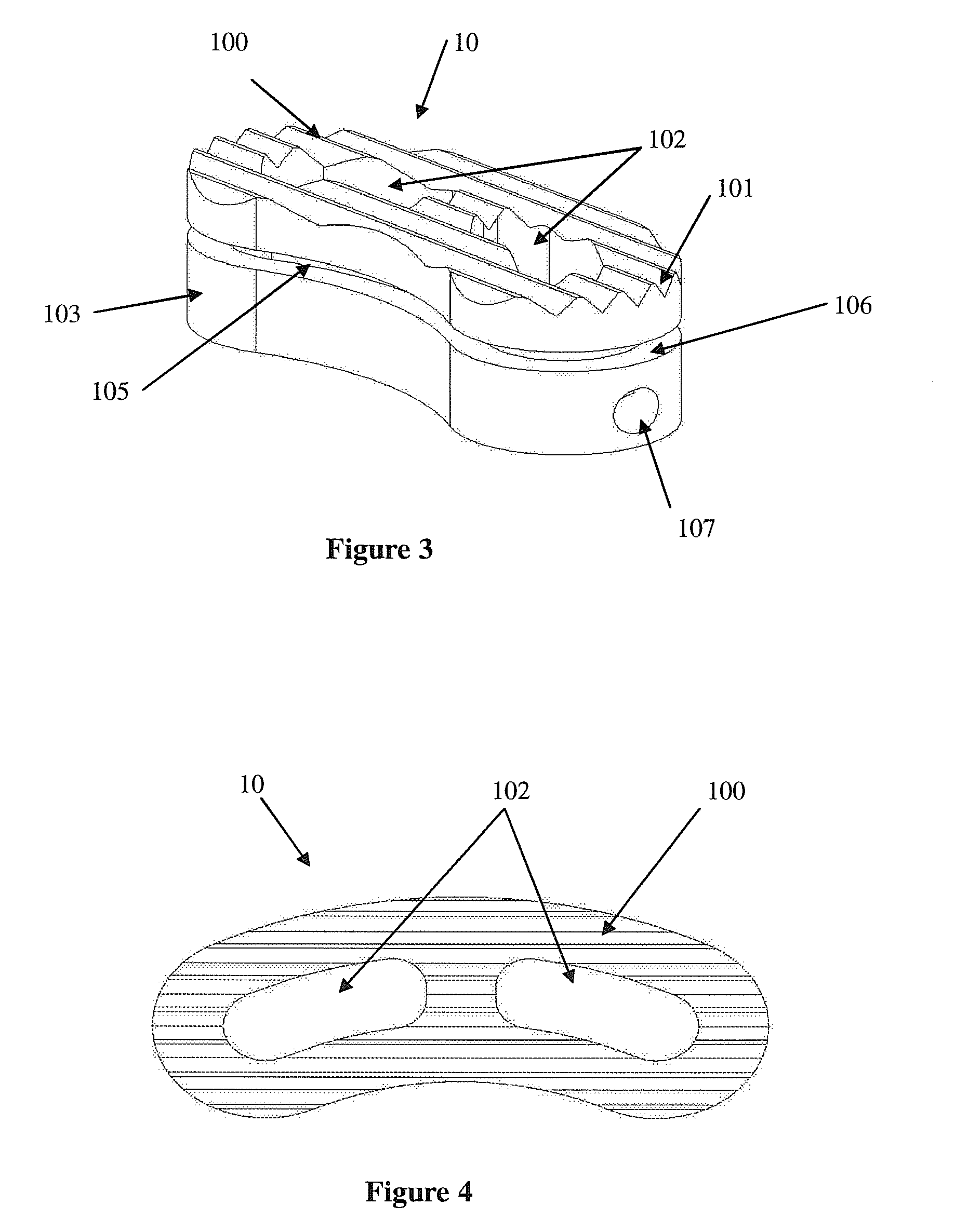 Load sharing interbody fusion device