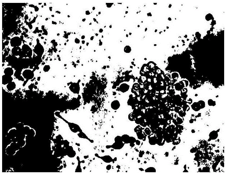 Culture method of breast cancer MCF-7 cell stem cell levitated spheres