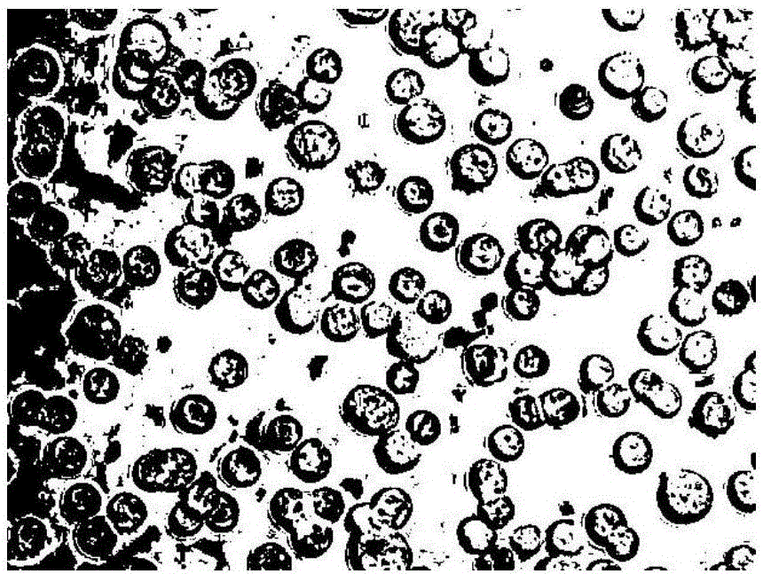 Culture method of breast cancer MCF-7 cell stem cell levitated spheres