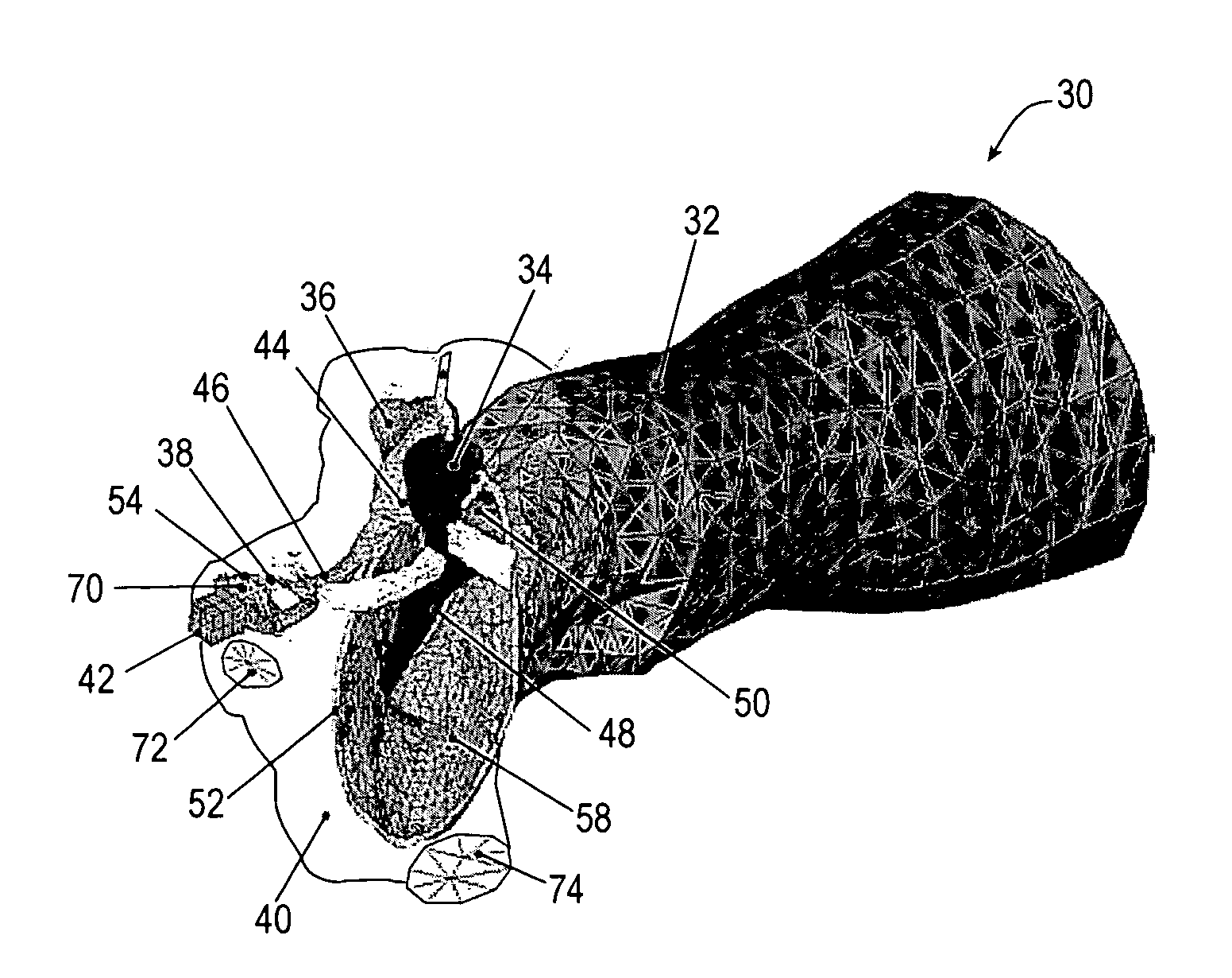 Three-dimensional finite element modeling of human ear for sound transmission