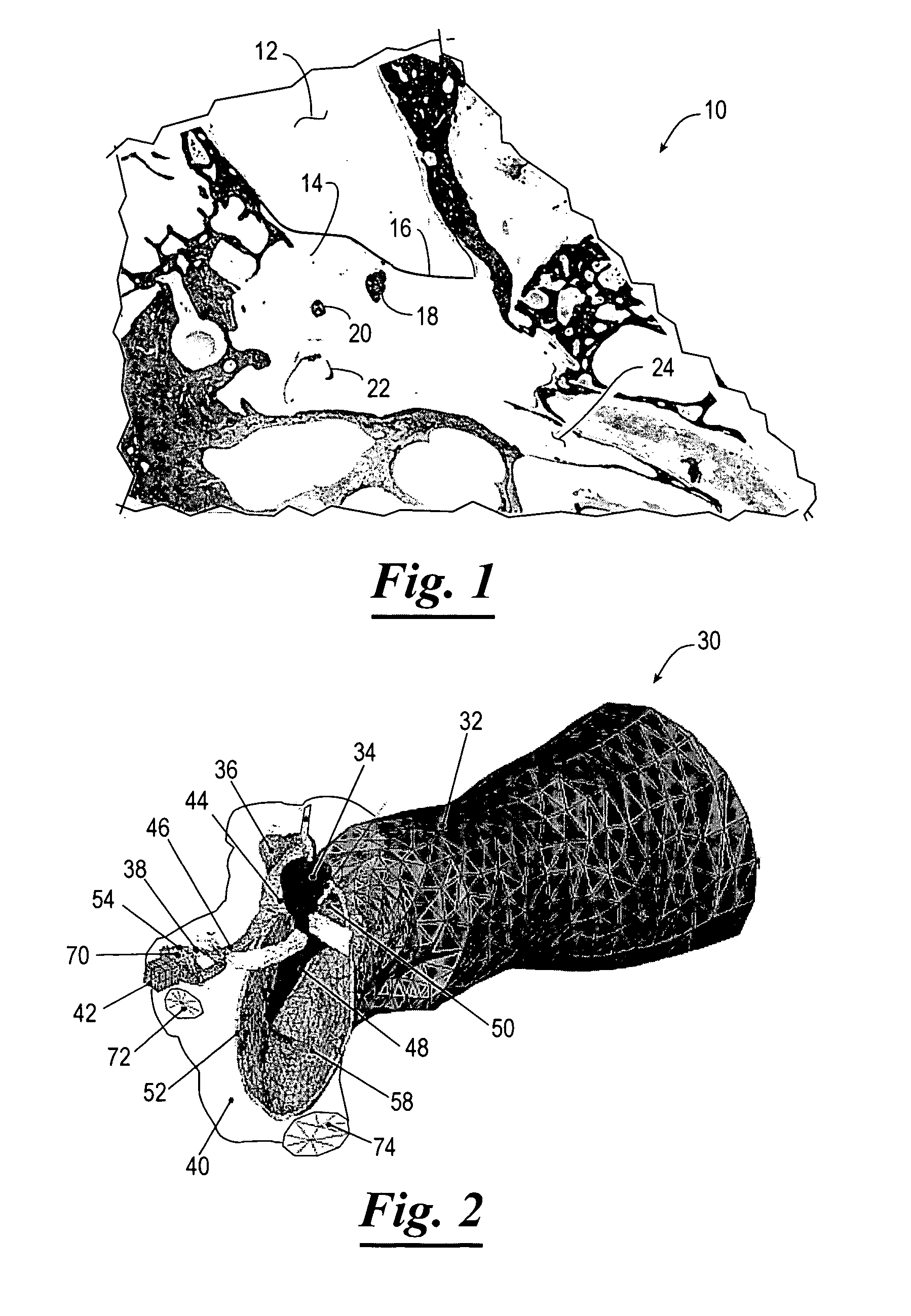 Three-dimensional finite element modeling of human ear for sound transmission