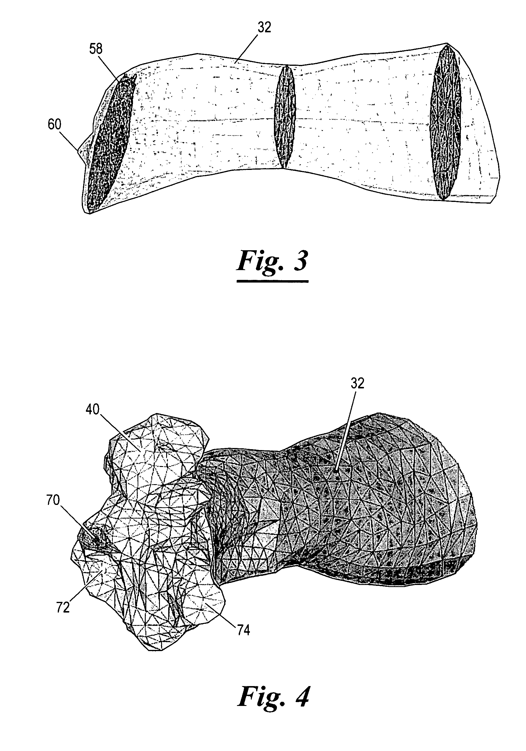 Three-dimensional finite element modeling of human ear for sound transmission