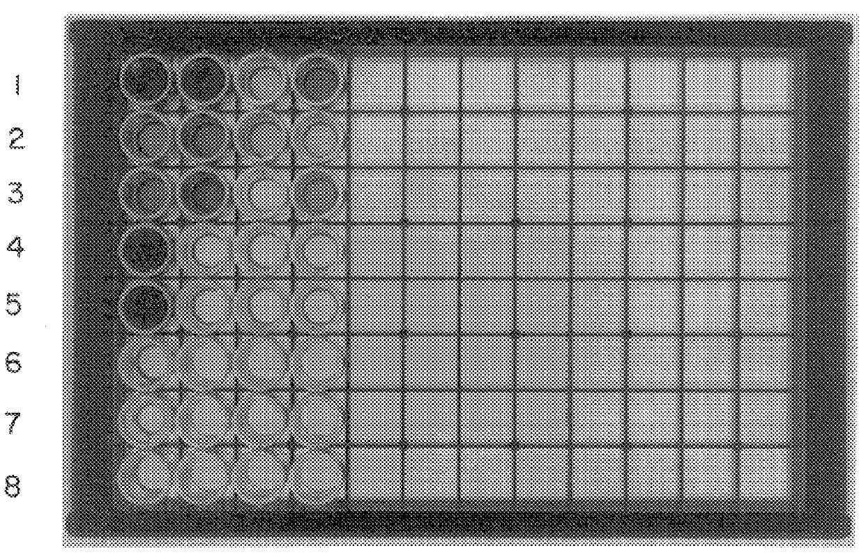 PCR identification and quantification of important Candida species