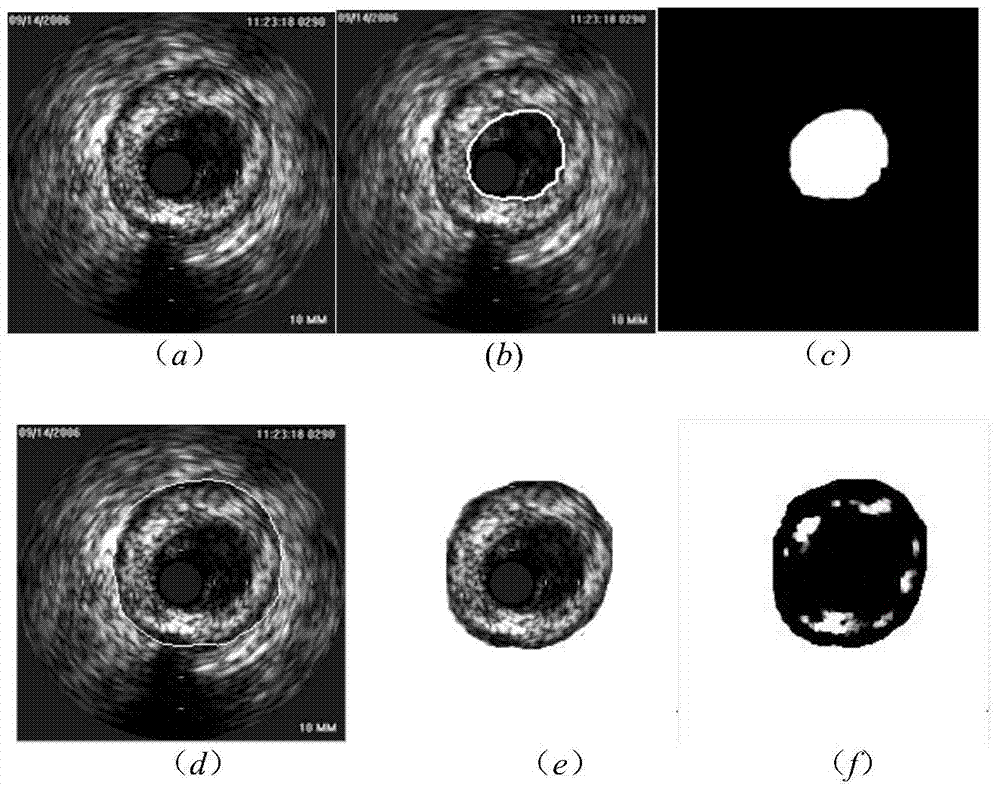 Blood vessel ROI dividing method based on intravascular ultrasonic image