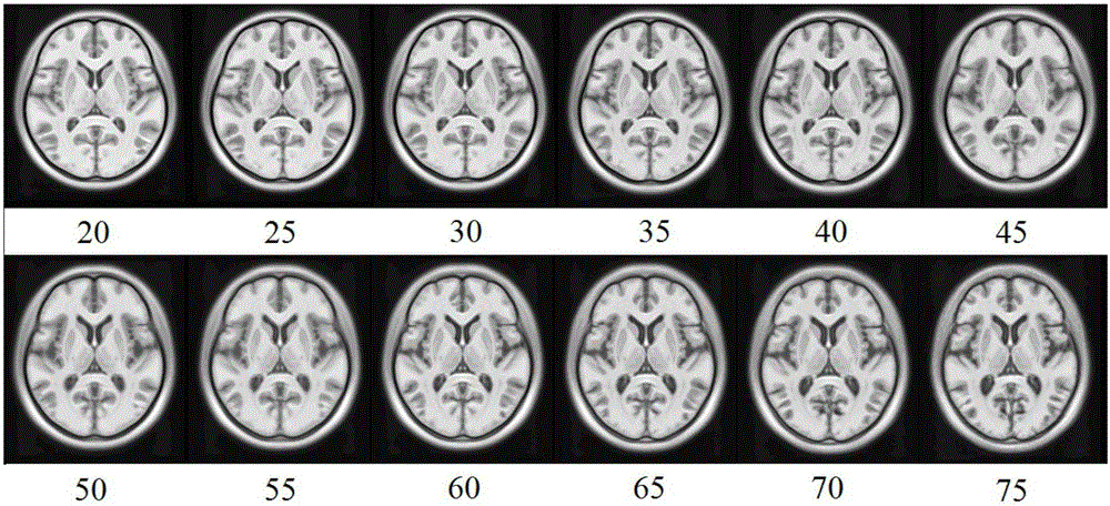 Brain template generating method