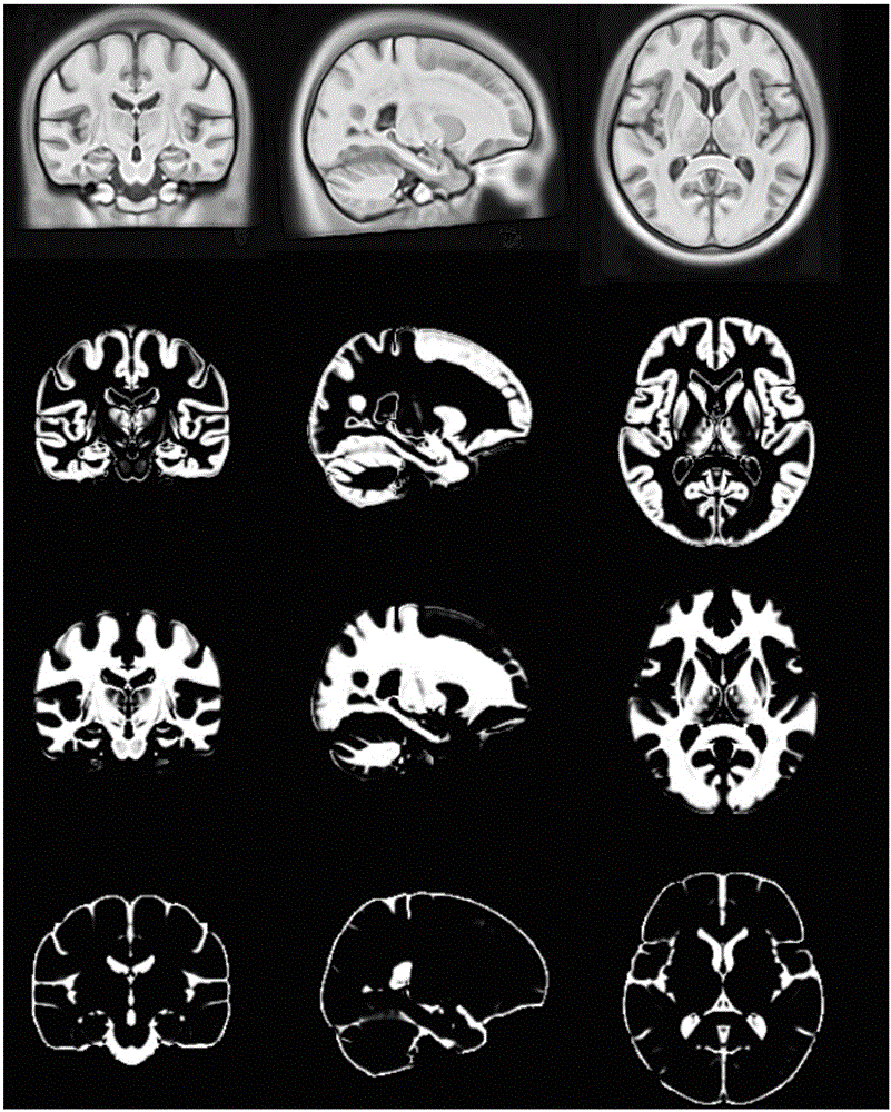 Brain template generating method