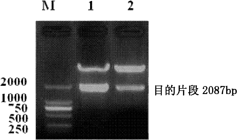 Recombinant expression vector of Hsp65-hIL-2 fusion expression and recombinant strain