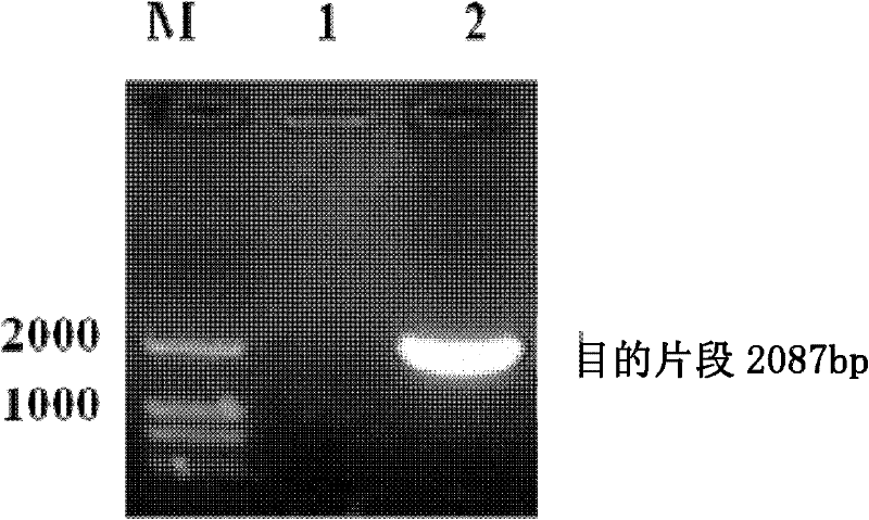 Recombinant expression vector of Hsp65-hIL-2 fusion expression and recombinant strain