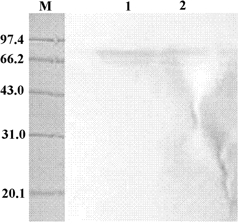 Recombinant expression vector of Hsp65-hIL-2 fusion expression and recombinant strain