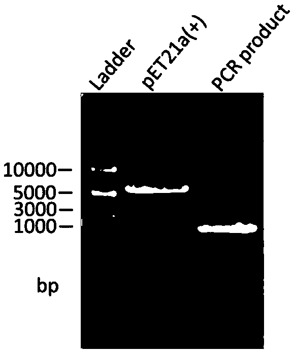 Preparing and detecting method for bacterium phosphopantetheinyl transferase antibody