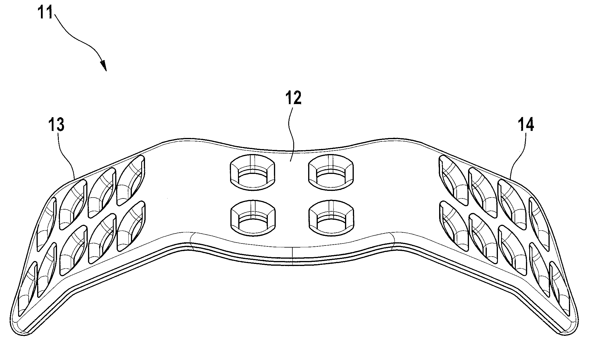 Implant for spreading the nasal wings