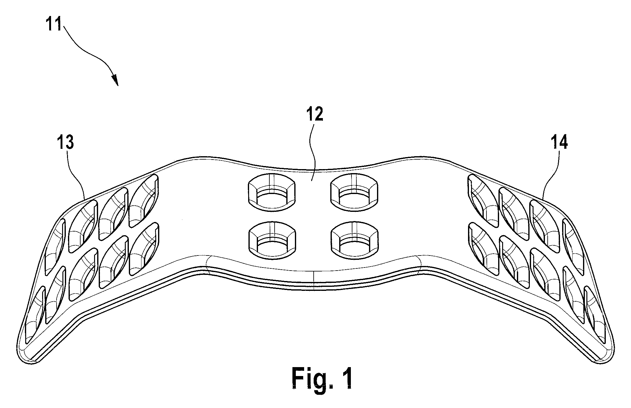 Implant for spreading the nasal wings