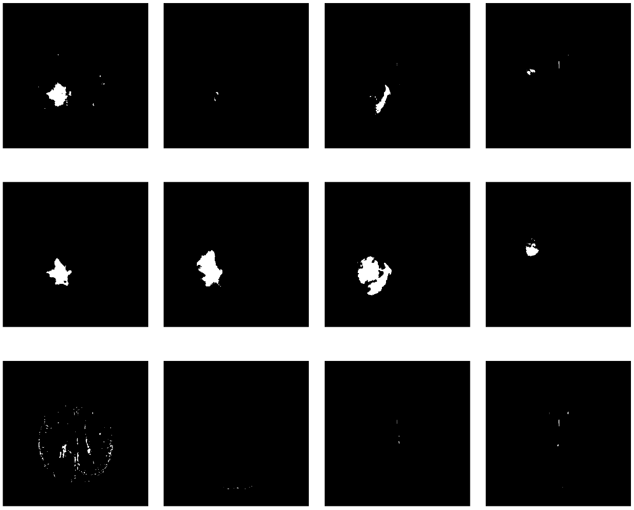 Medical image synthesis method based on generation countermeasure network