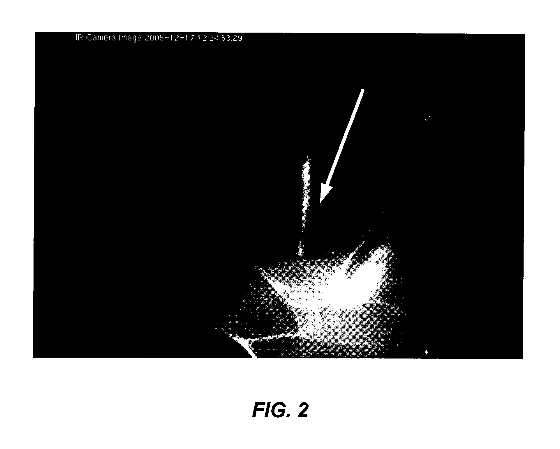 Intraoperative determination of nerve location