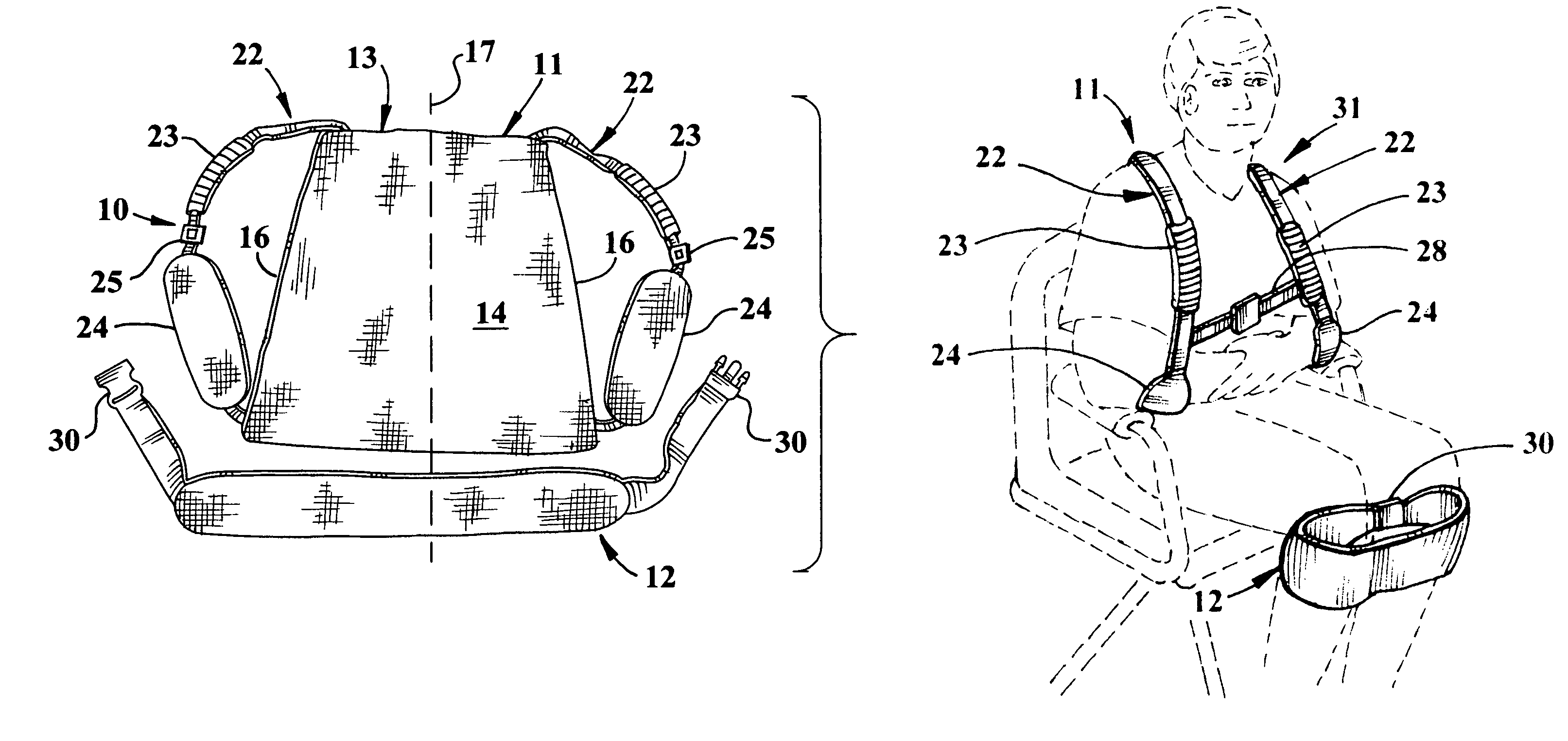 Portable patient transfer system