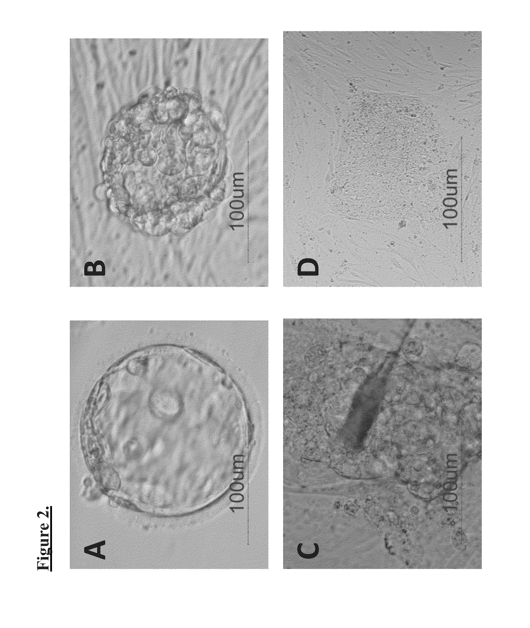 Production of parthenogenetic stem cells and patient-specific human embryonic stem cells using somatic cell nuclear transfer