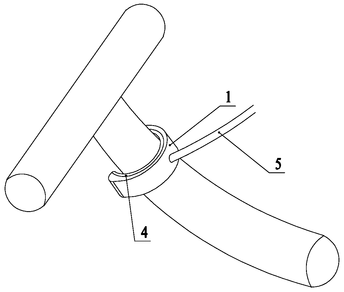 Flow-limiting device for high-flow internal arteriovenous fistula