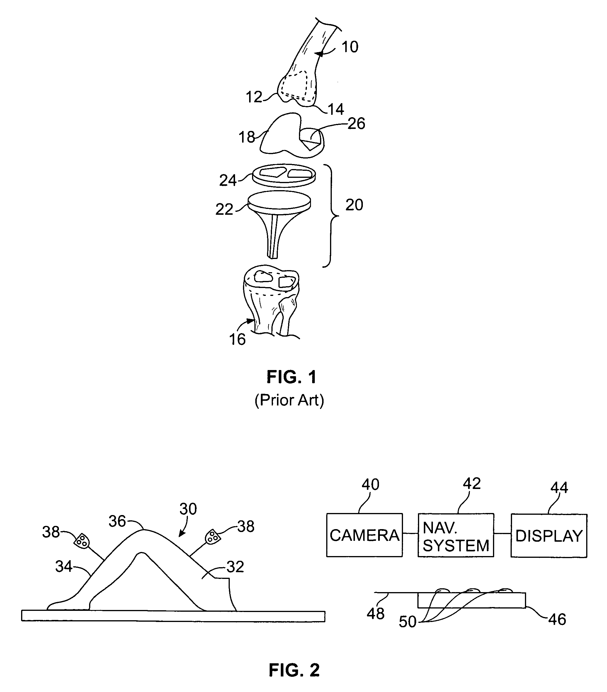 Method of and system for planning a surgery